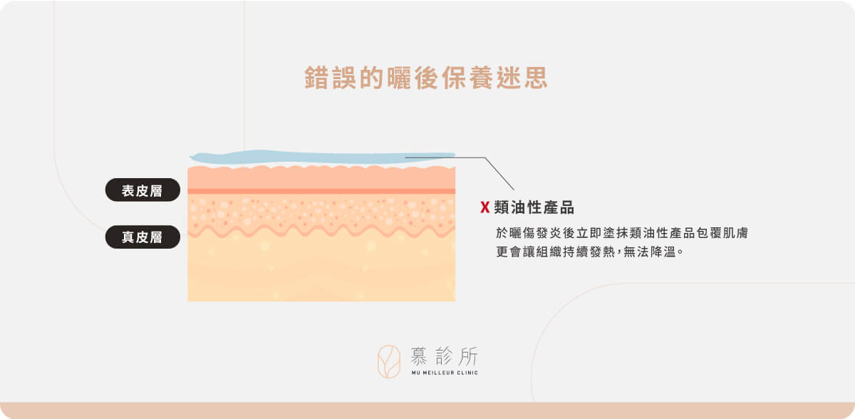 曬傷後該怎麼辦？原來這些事不能做？4