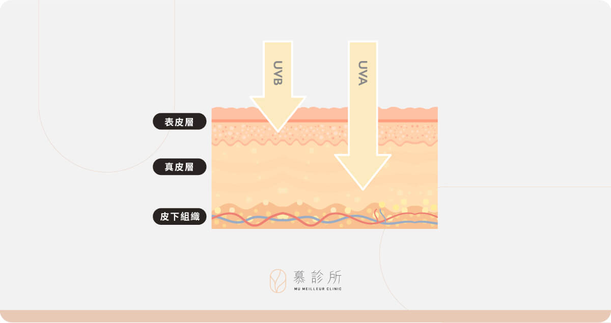 曬傷後該怎麼辦？原來這些事不能做？6