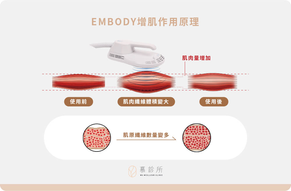 Embody - 慕診所 Mu Meilleur