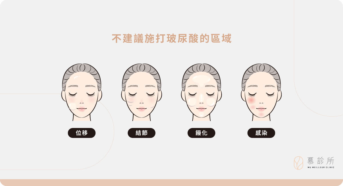 玻尿酸不是萬能！適合填補 vs 不建議施打的區域 ＿3