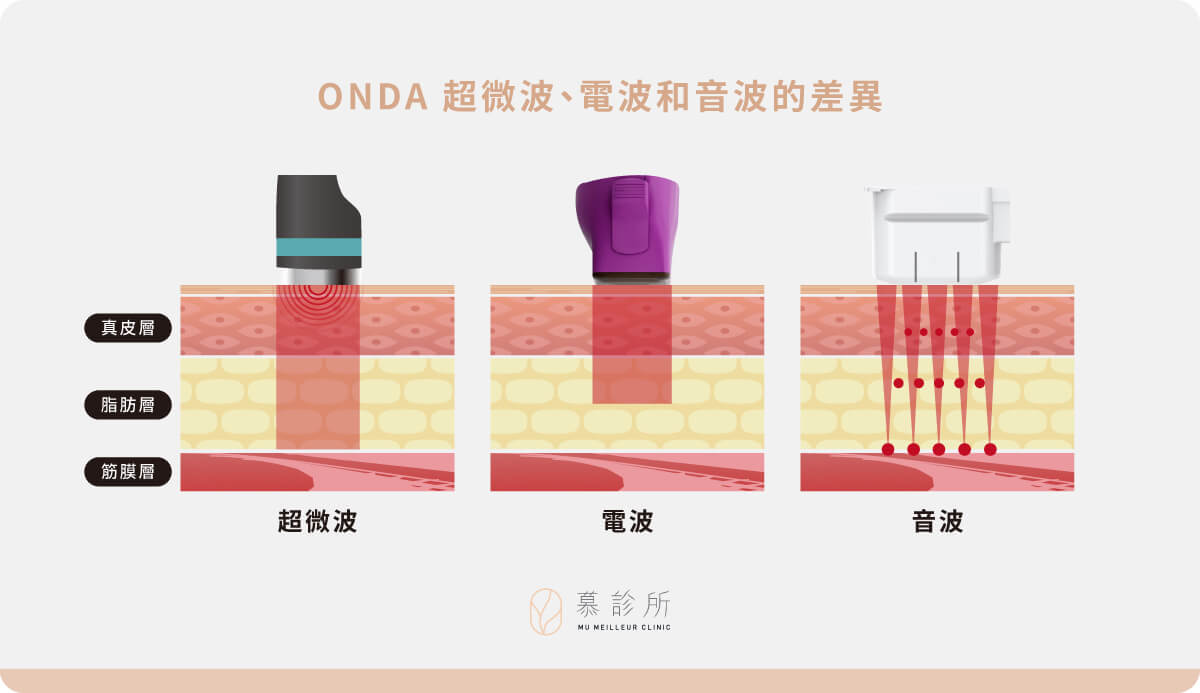 ONDA-超微波、電波和音波的差異2