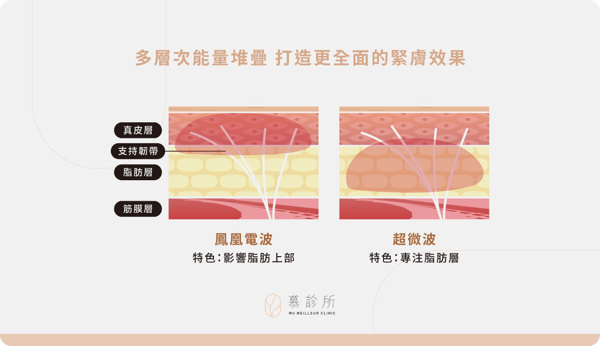 ONDA-超微波、電波和音波的差異4