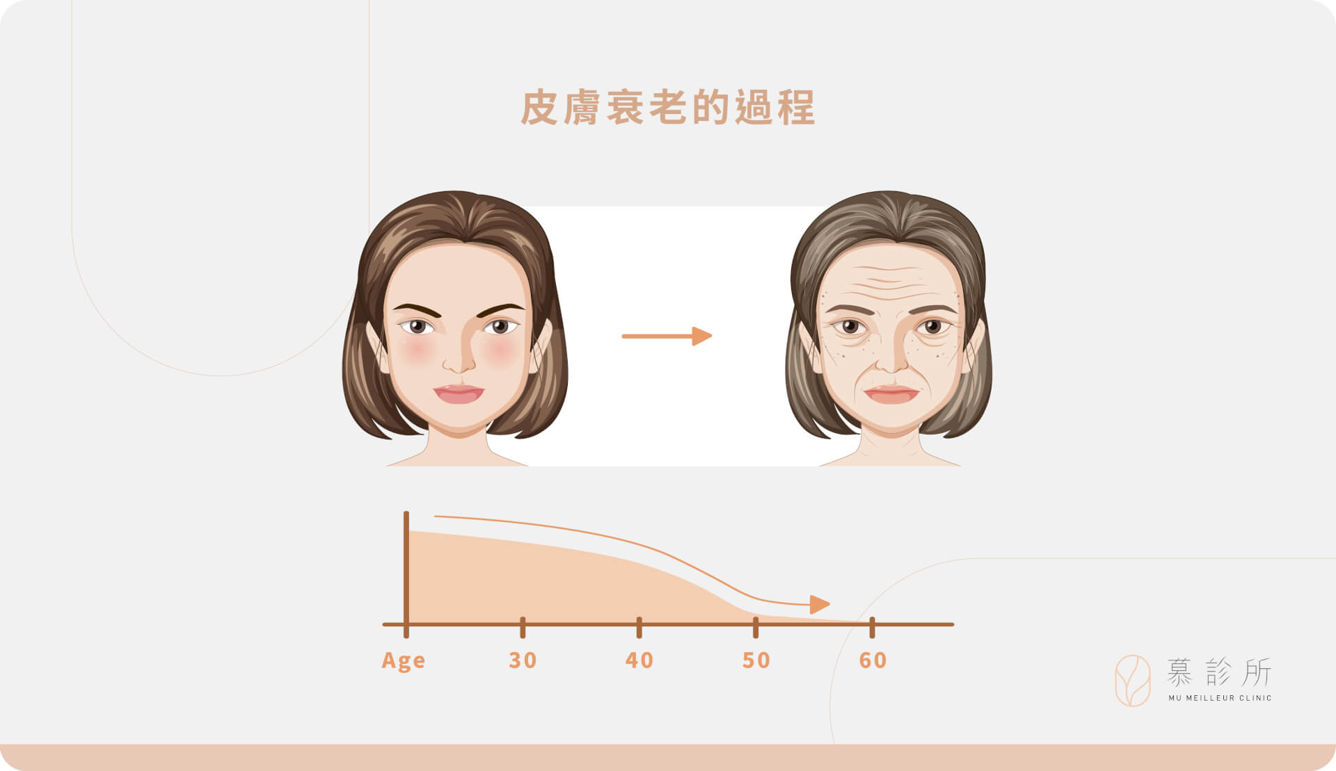 總覺得做了拉提，還是差那麼一點點？｜分層治療