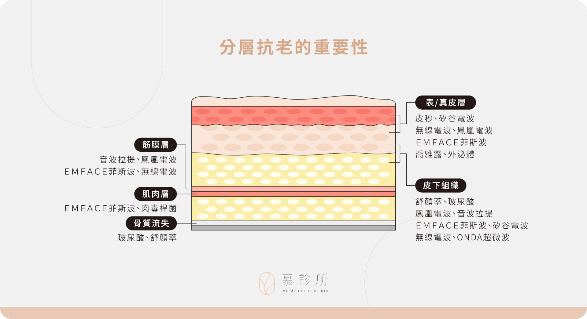 總覺得做了拉提，還是差那麼一點點？｜分層治療-2